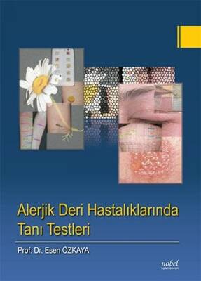 Alerjik Deri Hastalıklarında Tanı Testleri - 1