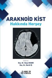 Araknoid Kist Hakkında Herşey - Nobel Tıp Kitabevleri