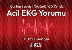 Çoktan Seçmeli Çözümlü 100 Örnek Acil EKG Yorumu - Nobel Tıp Kitabevleri