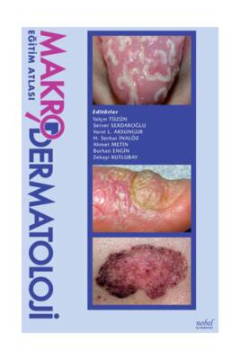 Makro Dermatoloji Eğitim Atlası - 1