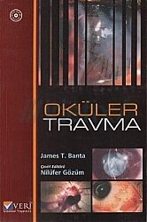 Oküler Travma / Gözüm - Nobel Tıp Kitabevleri
