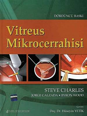 Vitreus Mikrocerrahisi - 1